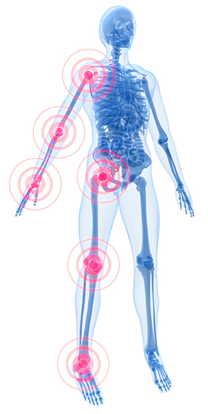foods-fight-inflammation